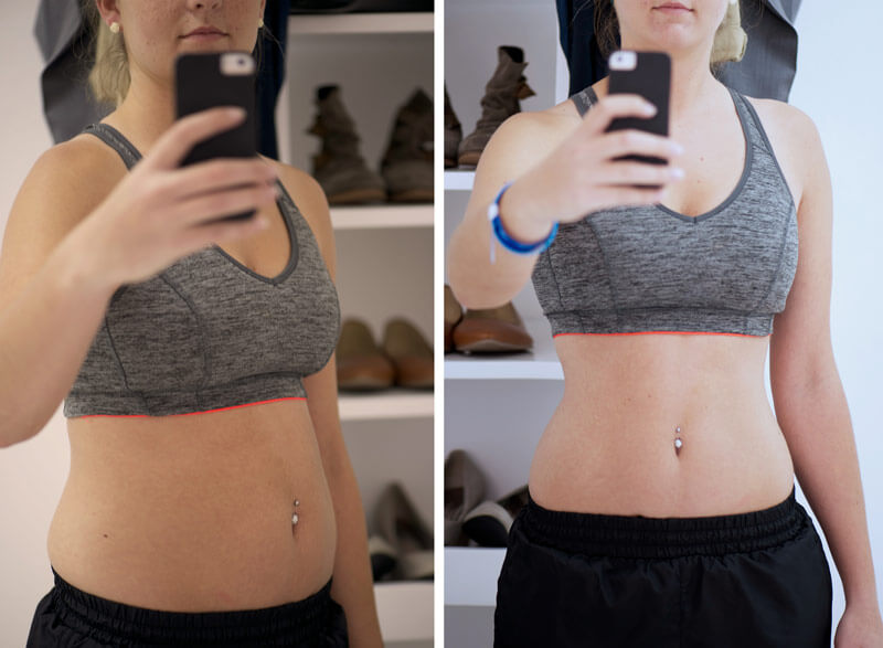 Before and after with weight management treatments